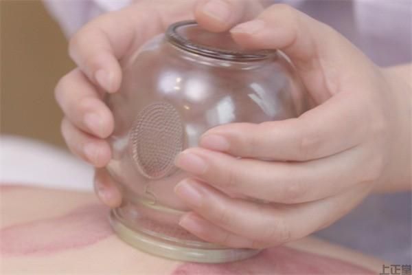 今日排行榜!真空拔罐后的注意事項有哪些